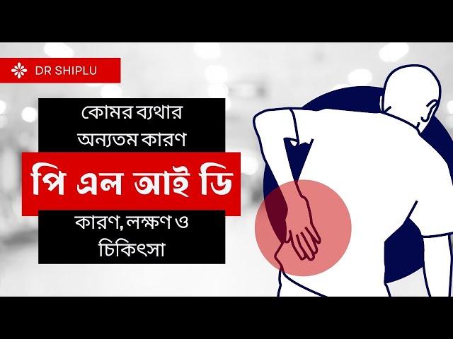 কোমর ব্যথার অন্যতম কারণ পি এল আই ডিঃ কারণ, লক্ষণ ও চিকিৎসা