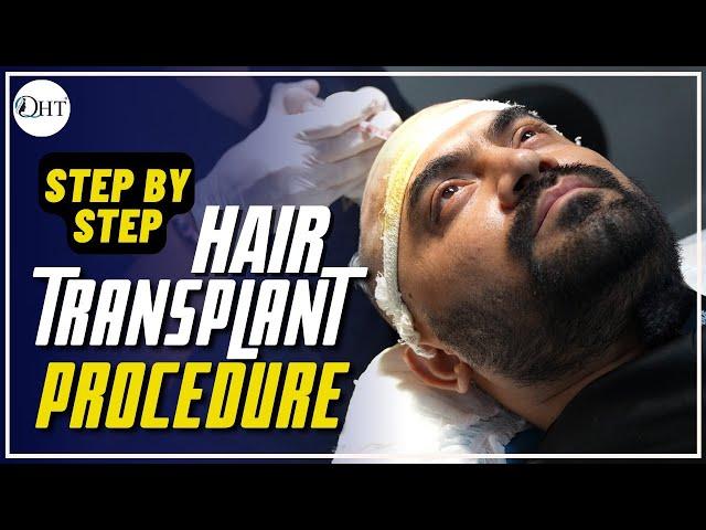 Step by Step QHT Hair Transplant Surgery in India |FULL PROCEDURE | QHT Clinic by Regrow, Haridwar