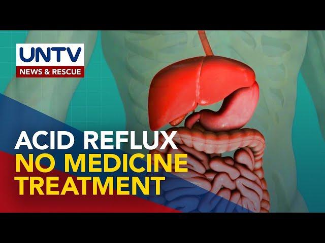 ALAMIN: Paglaban sa Acid Reflux ng Walang Iniinom na Gamot