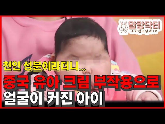 소아청소년과 의사가 본 중국 저질 아기크림 부작용 (스테로이드 부작용)