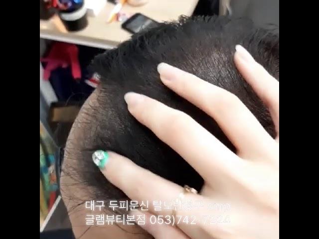 대구두피문신 두피반영구 글램뷰티본점