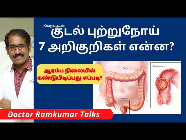 பெரும் குடல் புற்றுநோய் அறிகுறிகள் என்ன? கண்டுபிடிப்பது? சிகிச்சைகள்? Colorectal cancer Symptoms