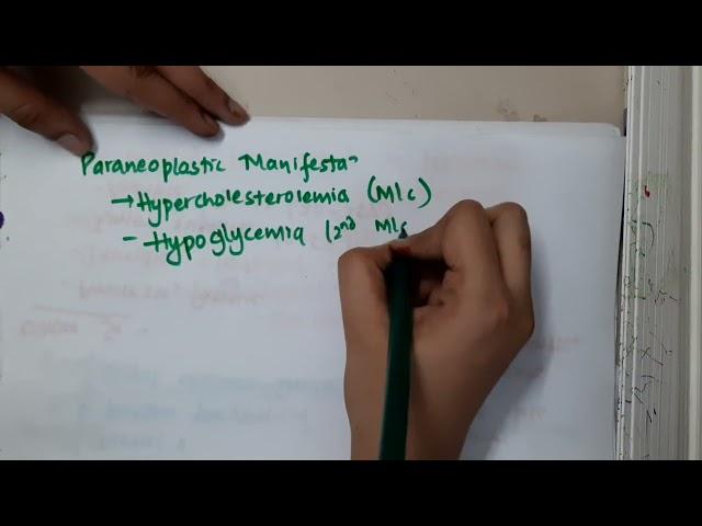 hepatocellular carcinoma part 1 II surgery  mp4