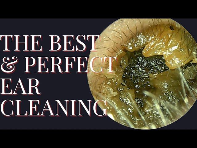 The BEST & PERFECT Ear Cleaning (Satisfying Result At The End)