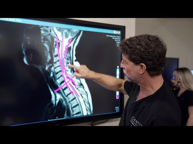 Symptoms of Cervical Stenosis | Jeffrey Cantor, MD