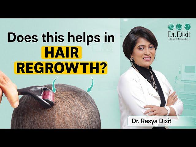 Derma roller For Hair Growth | Best Dermatologist In Bangalore | Dr. Rasya Dixit