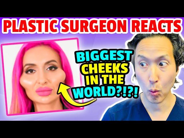 Plastic Surgeon Reacts to LARGEST Cheeks in the World! EXTREME Bodies EXPLAINED!