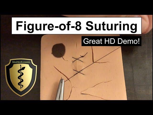 SUTURE Tutorial: Figure-of-8 Technique - Step-by-Step HD Instructions!