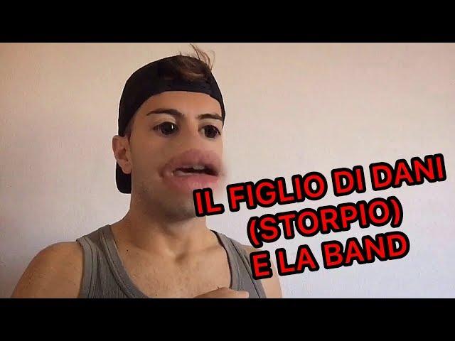 IL FIGLIO DI DANI (STORPIO) E LA BAND