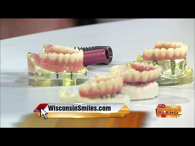 Your Different Options for Dental Implants