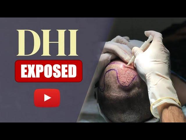 What is the DHI hair transplant? [SIMPLY EXPLAINED]