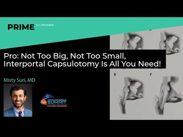 Pro: Not Too Big, Not Too Small, Interportal Capsulotomy Is All You Need! - Misty Suri, MD