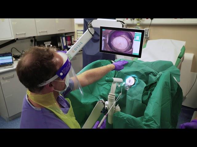 Cervical Rotating Biopsy Punch & LLETZlearn® Training Simulator in Conjunction with DYSIS Medical