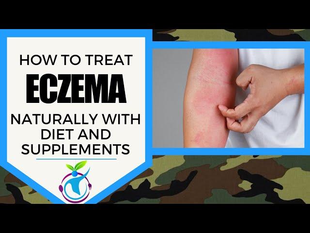 ECZEMA - How To Treat It Naturally With Diet & Supplements