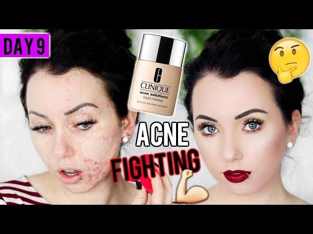 CLINIQUE ACNE SOLUTIONS FOUNDATION {First Impression Review & Demo!} 15 DAYS OF FOUNDATION