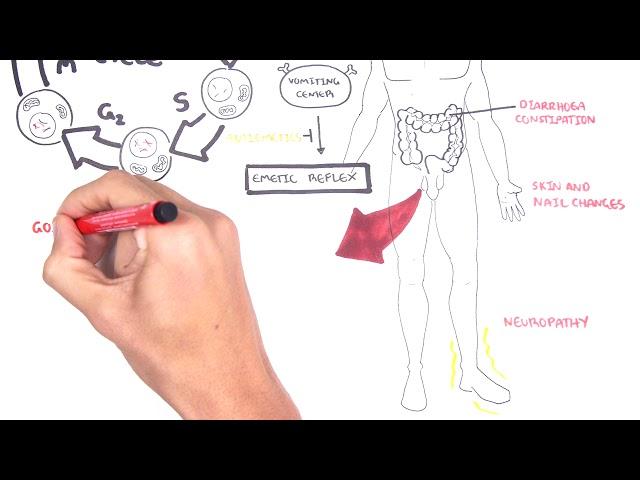 Acute Complications of Chemotherapy (side effects, adverse effects)