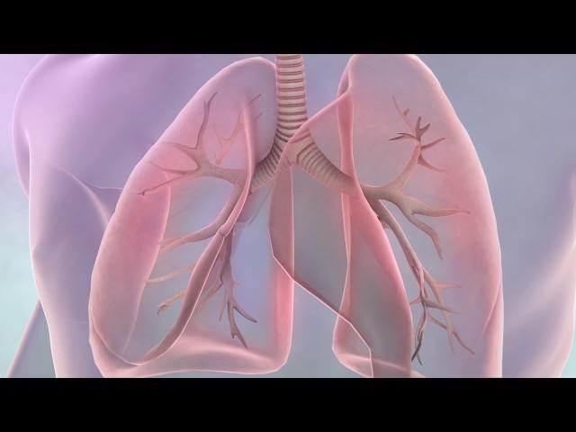 Symptoms of lung cancer