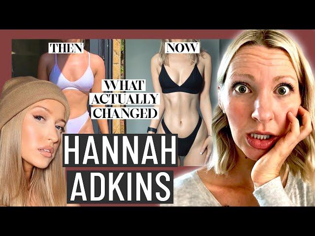 Dietitian Reviews Hannah Adkin's Tips for Losing Fat (Yikes... be careful what "experts" you trust)