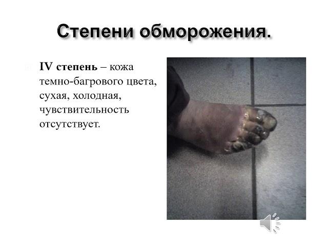 Термические повреждения ПП