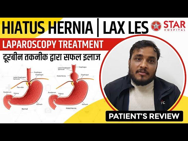 Best Hernia Hospital In Nawanshahr | Hernia Treatment In Nawanshahr | Hernia Doctor In Nawanshahr