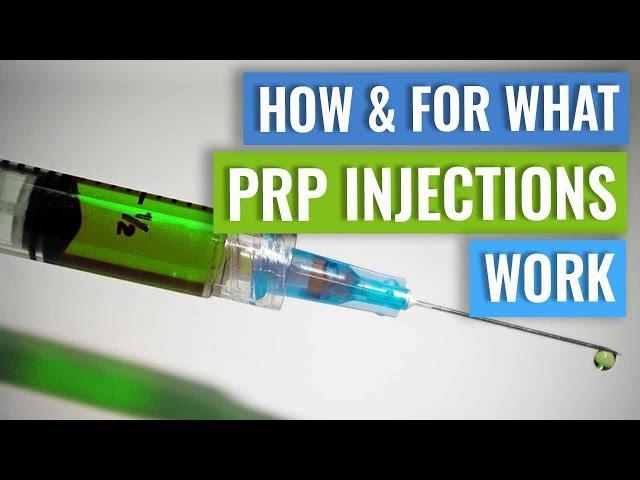 How do PRP injections work?