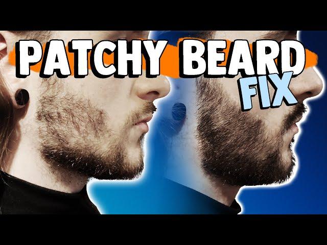 HOW TO FIX A PATCHY BEARD | 6 Methods to fix your patchy beard!