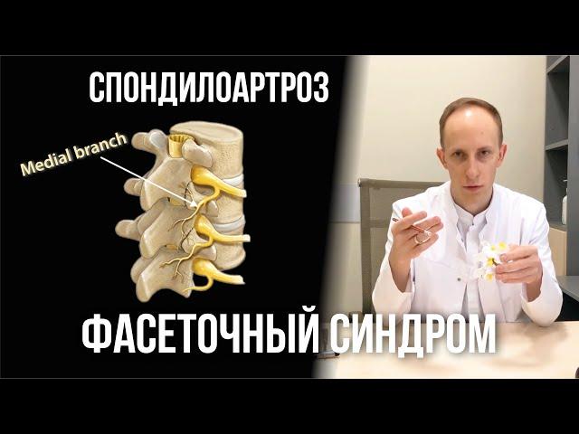 Спондилоартроз | Фасеточный болевой синдром | Блокада и денервация межпозвонковых суставов