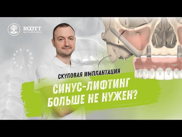 Скуловая имплантация без синус-лифтинга