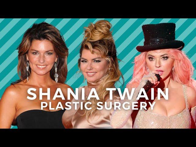 Shania Twain before and after plastic surgery: did Shania have a facelift?