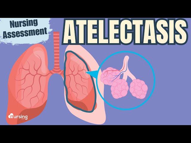 Atelectasis- Pathophysiology and Nursing Assessment