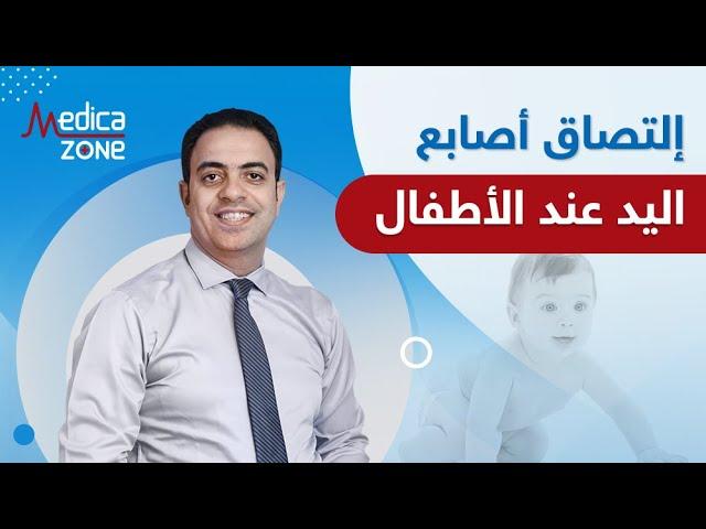 التصاق اصابع اليد عند الاطفال مع دكتور محمد فتحي | Medicazone