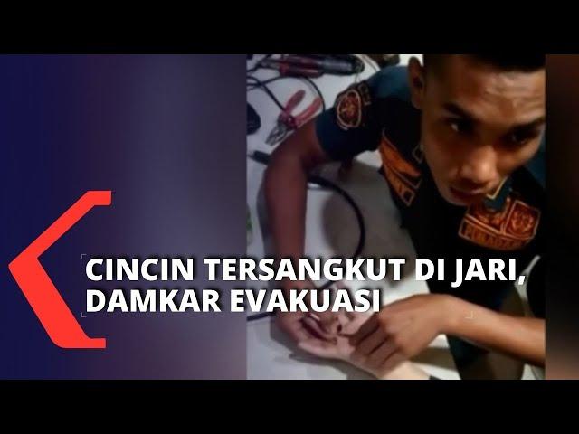 Menyempit, Ibu Asal Medan Minta Bantuan Damkar untuk Keluarkan Cincin Emas Imitasi dari Jarinya