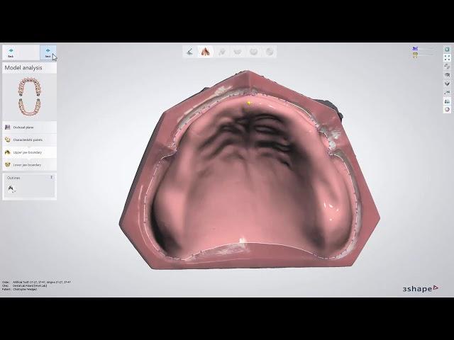 3DBioCAD - 3Shape Dental System Full Denture Design