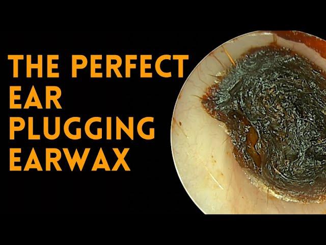 The Perfect Ear Plugging Earwax