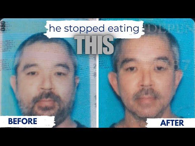 Stop the Standard American Diet