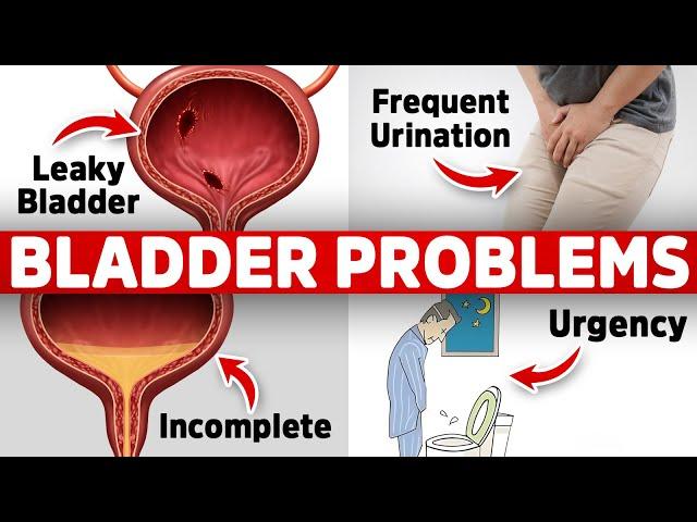 The #1 Vitamin Deficiency behind Bladder Issues (Freq. Urination, Leaky, Urgency)