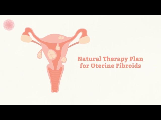 Uterine Fibroids and Fertility