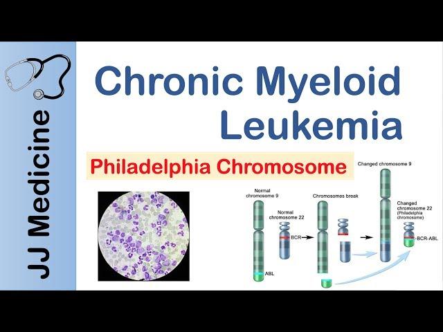 Chronic Myeloid Leukemia (CML) | Pathogenesis, Symptoms and Treatment