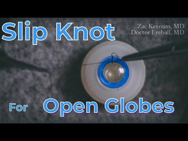 Slip Knot Technique for Open Globe Repair | Ophthalmology | Narrated by Young Surgeon