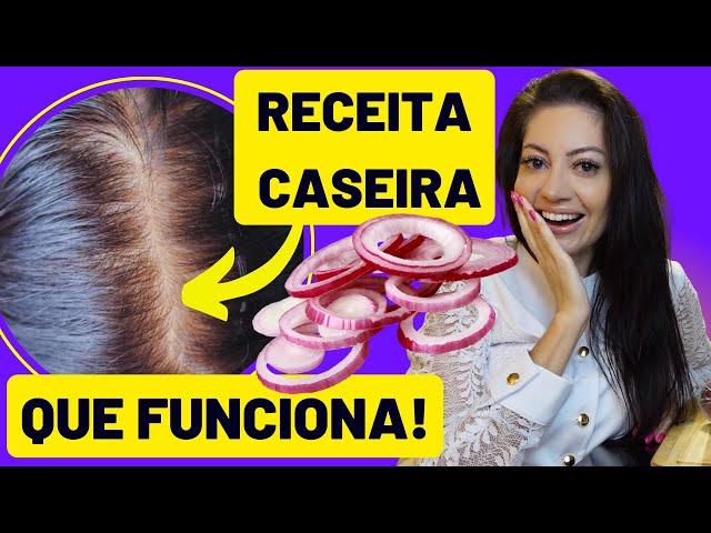 USE this HOME RECIPE to DECREASE HAIR FALL IN 2 WEEKS! | Dra. Greice Moraes