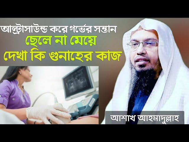 আল্ট্রাসাউন্ড করে গর্ভের সন্তান ছেলে না মেয়ে দেখা কি গুনাহের কাজ|জানলে অবাক হবেন।শায়খ আহমাদুল্লাহ