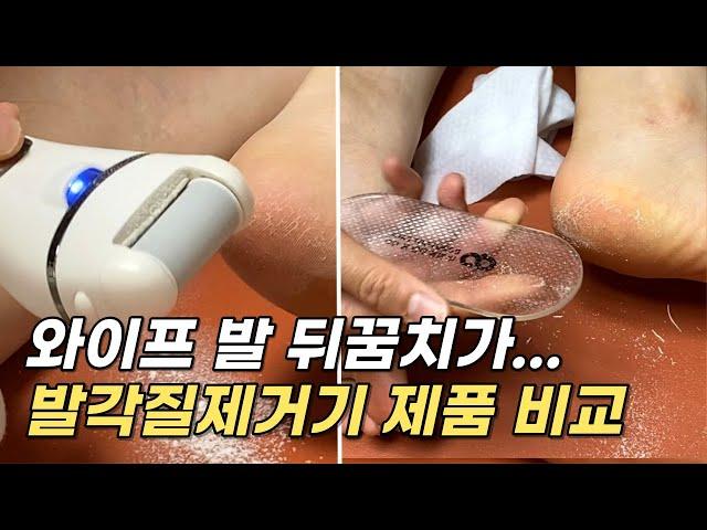 발 뒤꿈치 각질 셀프 제거방법 / 판매량 많은 발각질제거기 2종 비교 사용후기