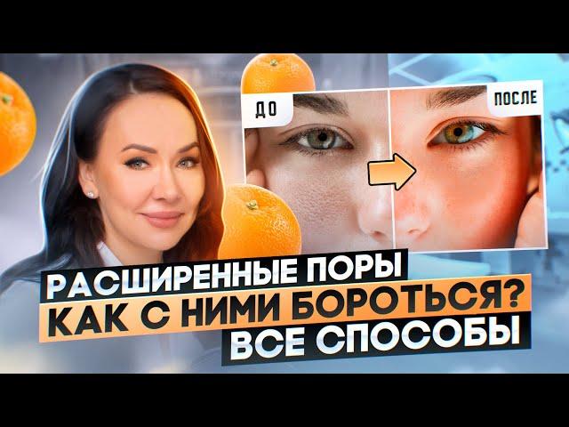 Расширенные поры - не приговор. Как сузить поры дома и у косметолога. Все способы.