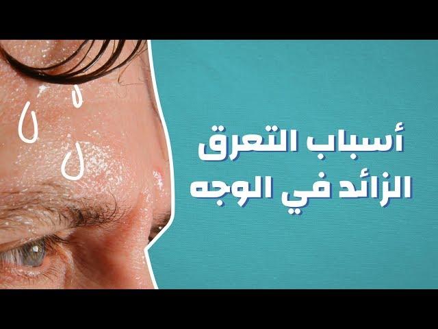 أسباب التعرق الزائد في الوجه #موضوع