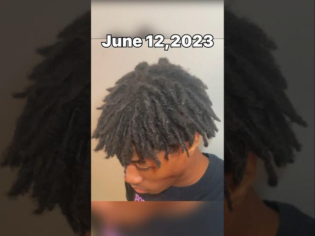 My 1 year dread journey #shorts #short #dreadjourney #dreads #freeformdreads #locs #kaicenat