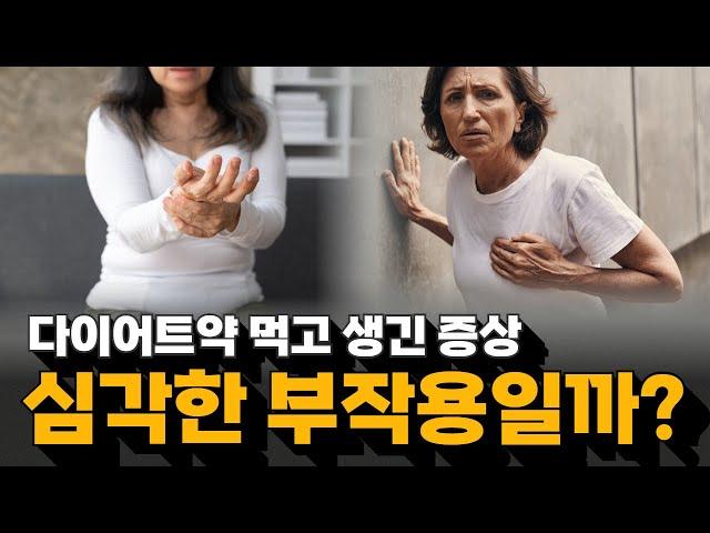 다이어트약 먹으면 겪는 부작용 모음 | 전남대학교병원 심장내과 이기홍, 김형윤 교수