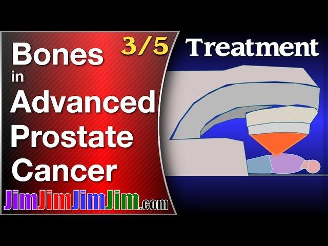 Treatment for metastatic prostate cancer in the bones