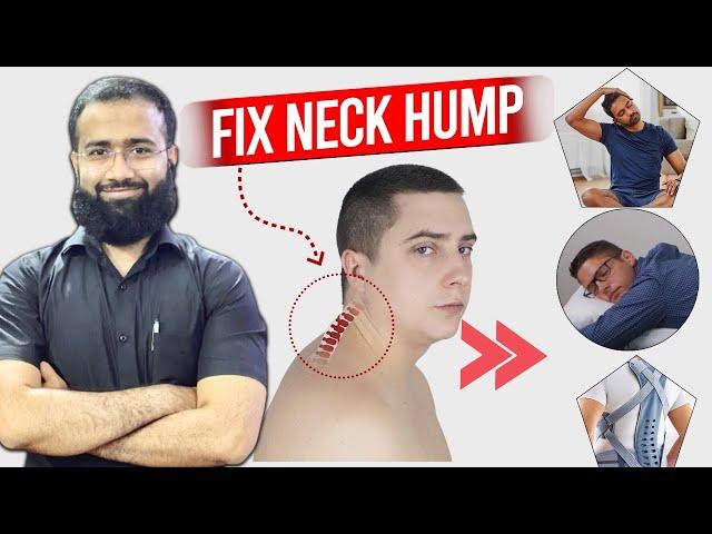 Fix your Bad Neck Posture | Neck Hump correction exercises