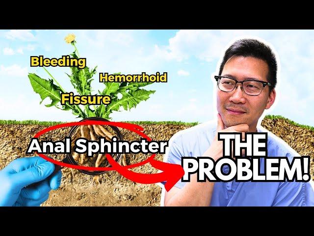 The REAL problem is the Internal Anal Sphincter!