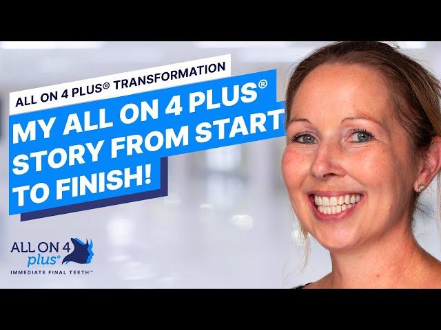 Susan's All On 4 Plus® Journey: A Step-by-step Guide To An Amazing Smile Transformation!